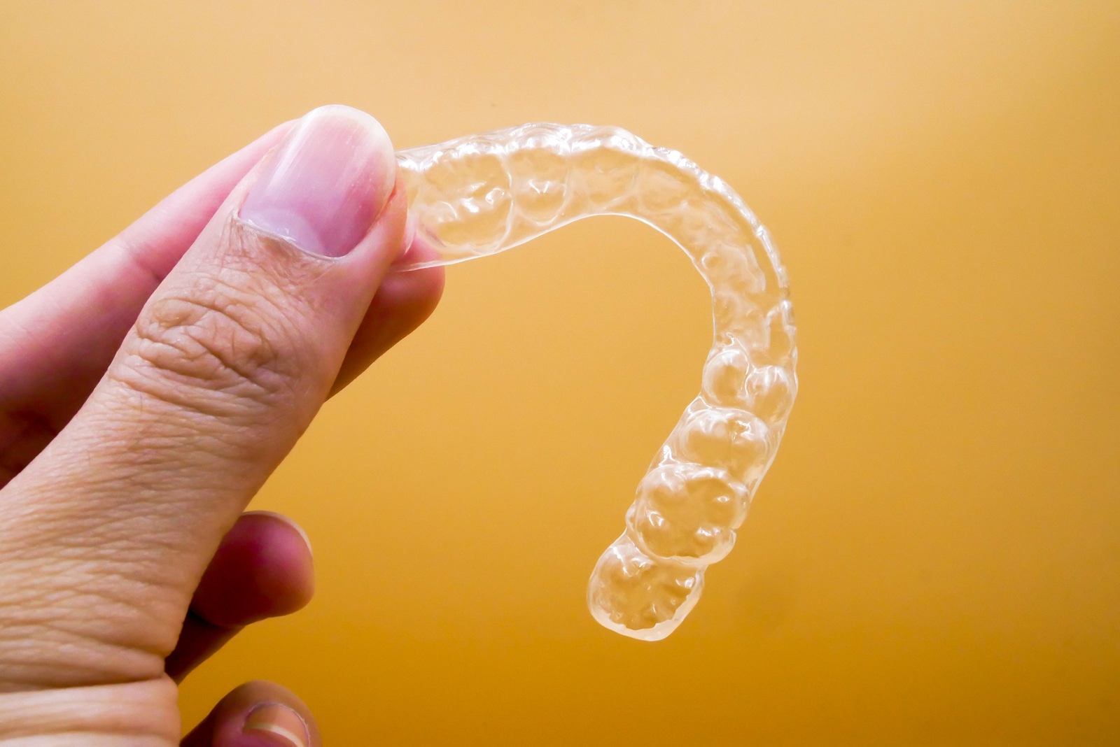 How Is Invisalign Different From Smile Direct Club? | Princeton ...