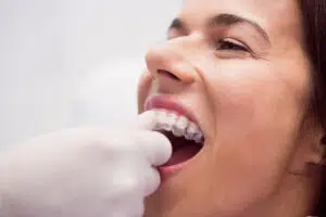 Invisalign Covered By Insurance