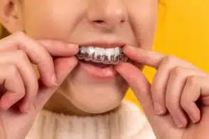 Orthodontics For Teens