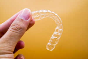 How Invisalign Works: A Step-by-Step Treatment Guide