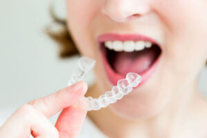 How Invisalign Works: A Step-by-Step Treatment Guide